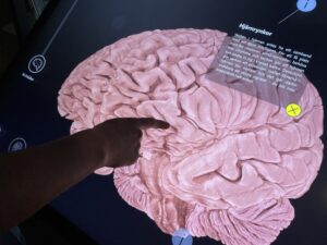 Person pekar på skärm med Hjärnrynkor
